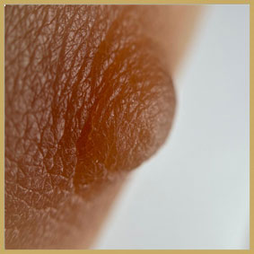 Areola_04